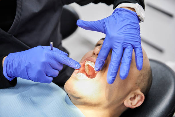 Best Emergency Root Canal Treatment in Crisfield, MD