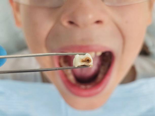 Best Orthodontic Emergency Dentist in Crisfield, MD